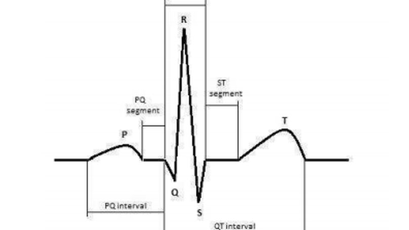 ECG signal classification using convolutional neural networks